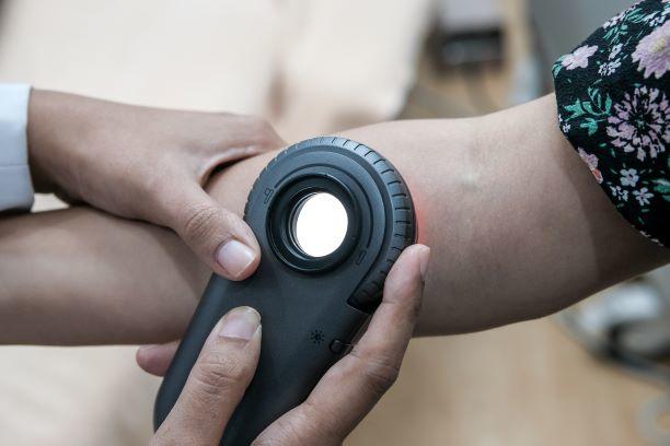 La mano de un médico usando un dermatoscopio para observar un lunar.