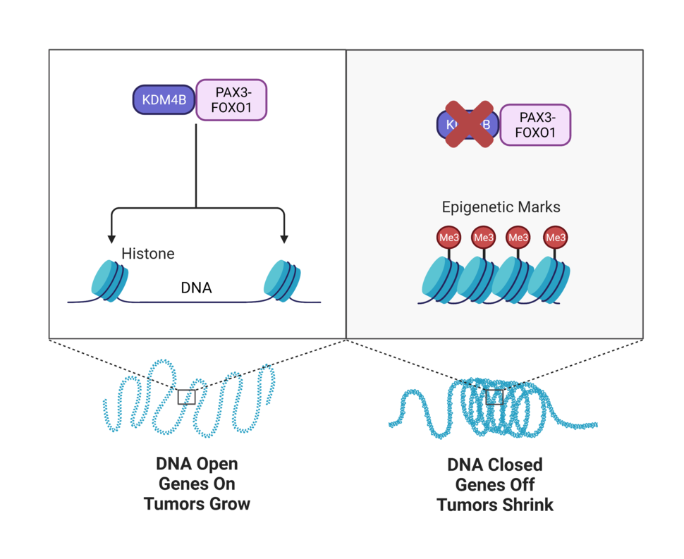 An illustration with two panels. On the left, PAX3-FOXO1 interacts with KDM4B in front of stretched-out DNA. On the right, KDM4B is crossed out and the DNA is wound up.