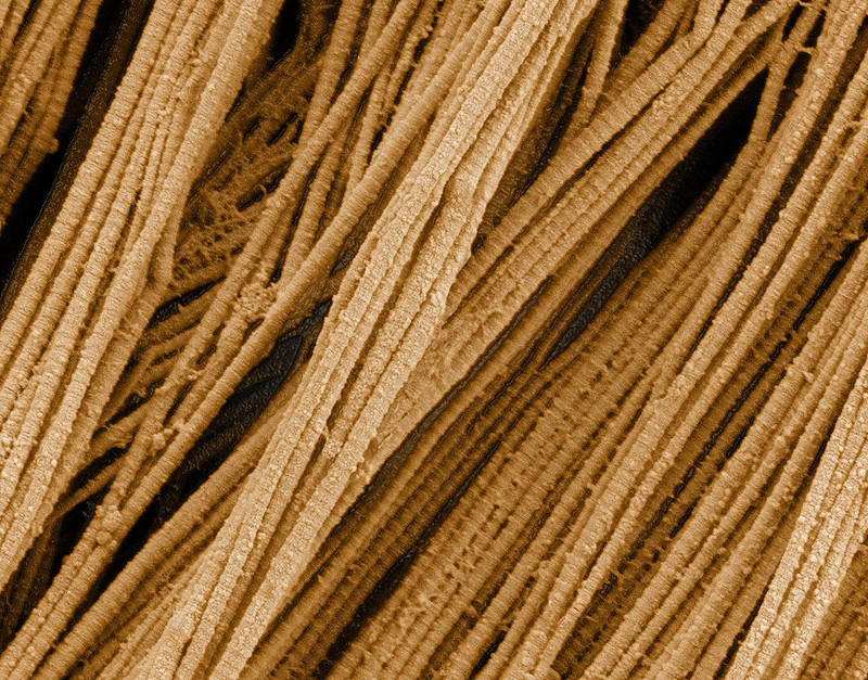 Scanning electron microscopy image of ropelike collagen fibers.