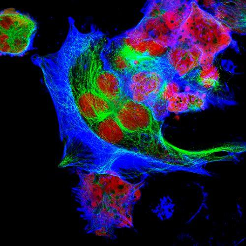 Imagen de células de neuroblastoma tomada con microscopio de fluorescencia. 
