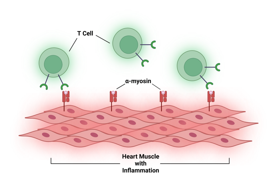 An illustration of T cells attacking inflamed heart tissue by binding to alpha-myosin.