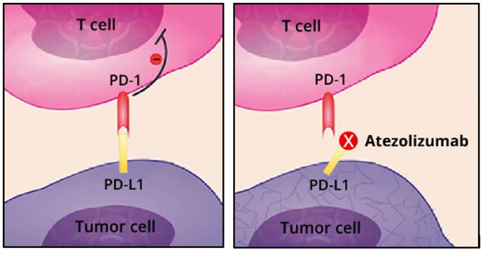 Graphic showing how atezolizumab blocks tumor cells' ablity to evade the immune system by blocking the binding of two checkpoint inhibitors, PD-1 and PD-L1. 
