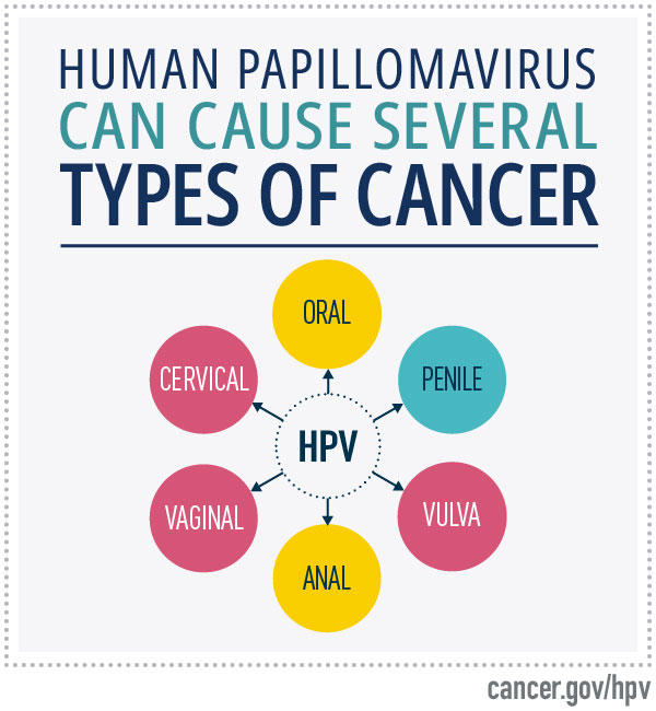 Human Papillomavirus can cause several types of cancer, including oral, penile, vulva, anal, vaginal, and cervical.