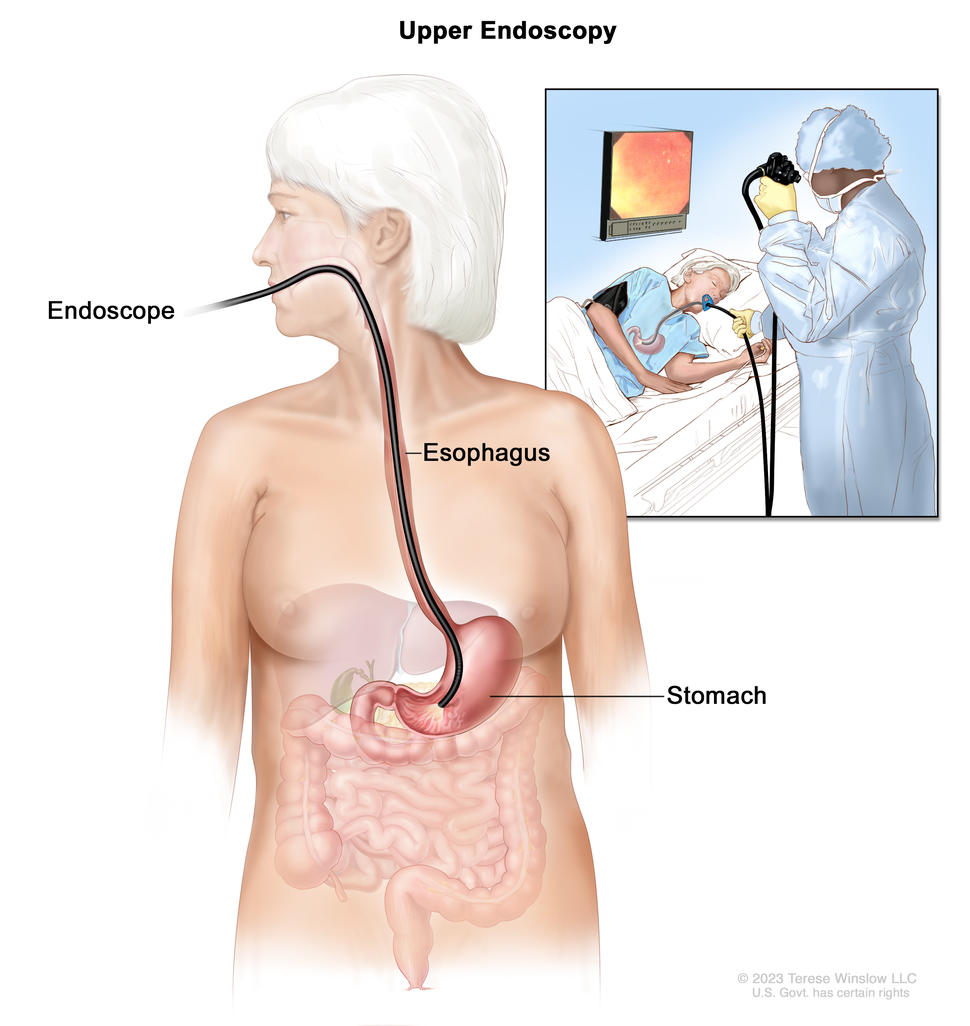 lower endoscopy procedure