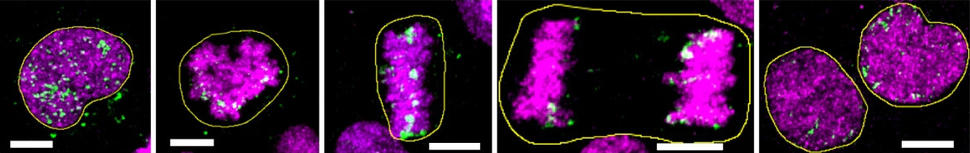 Five live-cell time-lapse images of a cancer cell with ecDNA dividing into two cells.