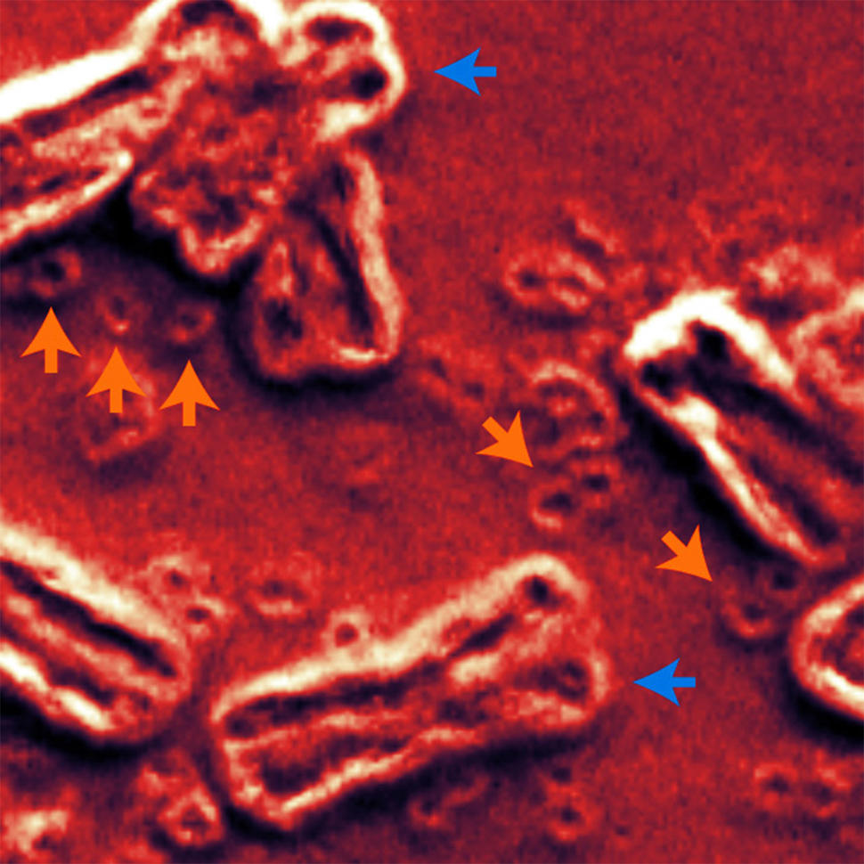 A scanning electron micrograph showing chromosomes and ecDNA