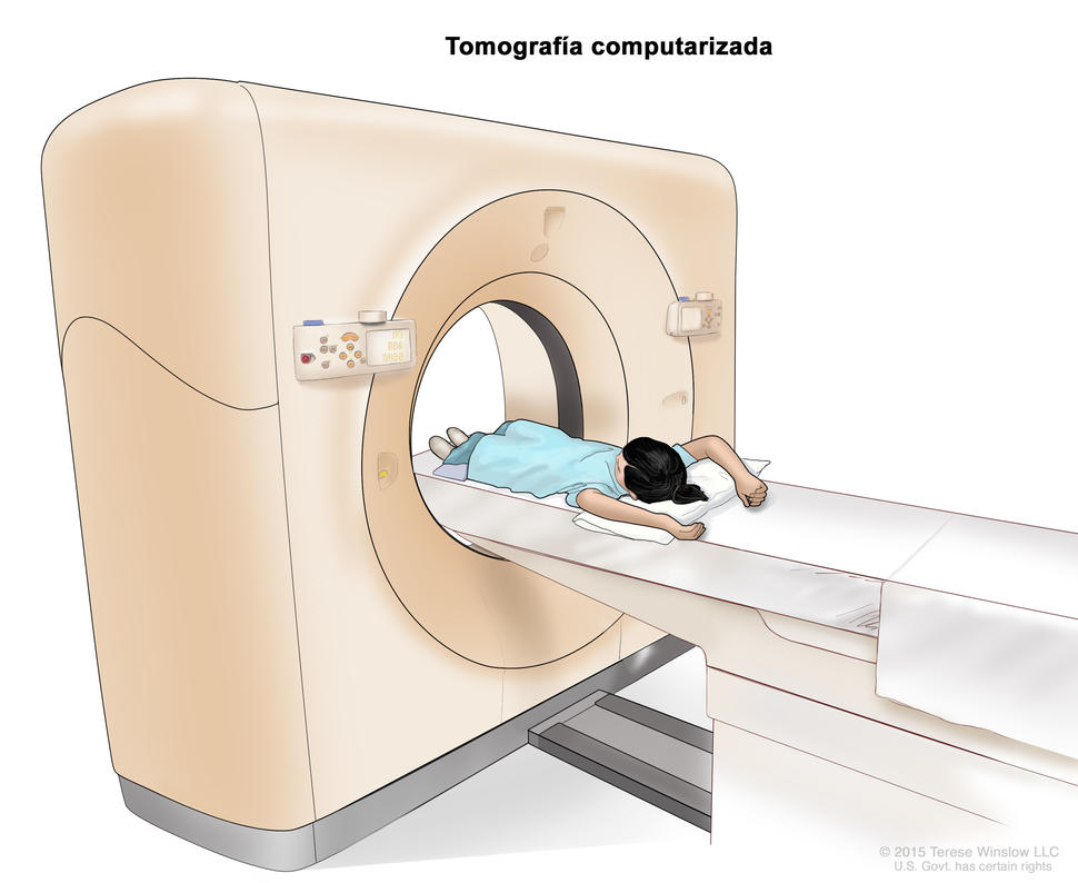 Tomografía computarizada (TC). En la imagen se observa una niña acostada sobre una camilla que se desliza a través del escáner de TC, con el que se toma una serie de imágenes radiográficas detalladas de áreas del interior del cuerpo.