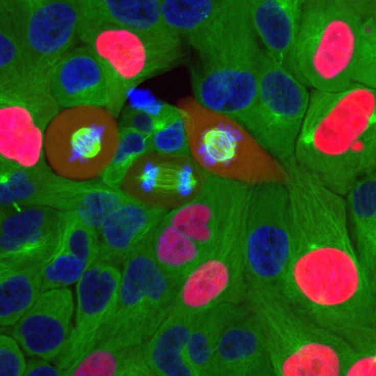 Breast cancer cells going through the cell cycle.  Credit: Cappell Lab