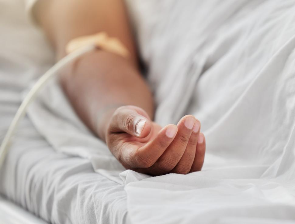 Foto del brazo de un paciente con una sonda intravenosa.