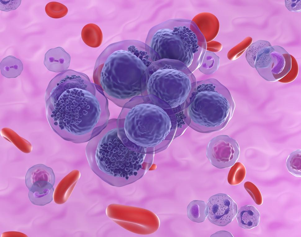 An illustration of AML cells floating among other cells