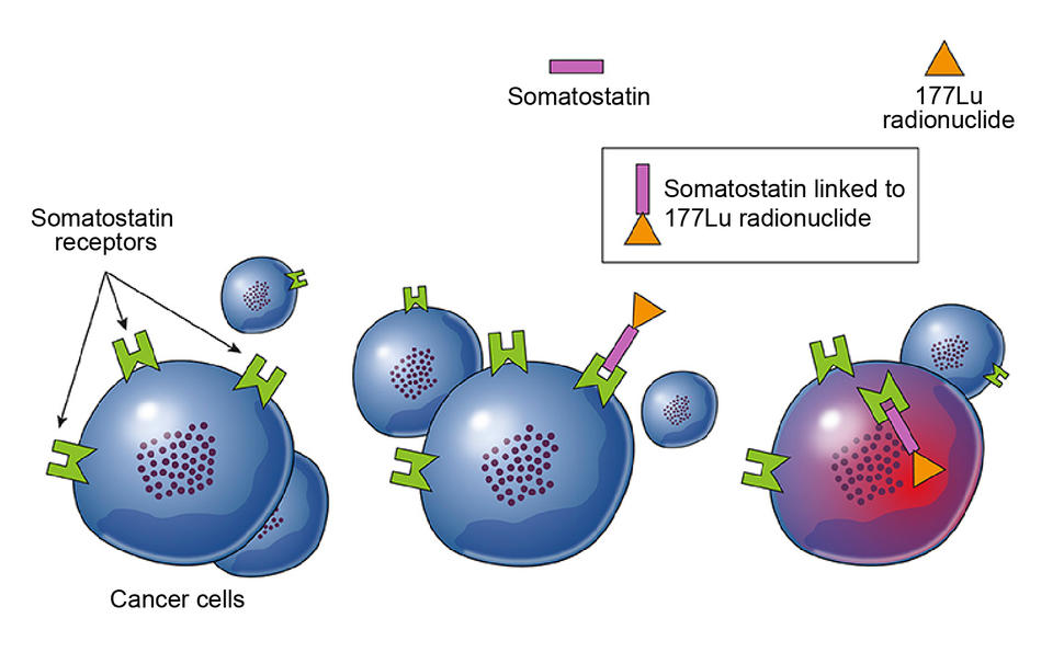 Somatostatin linked to 177Lu receptors on cancer cells.