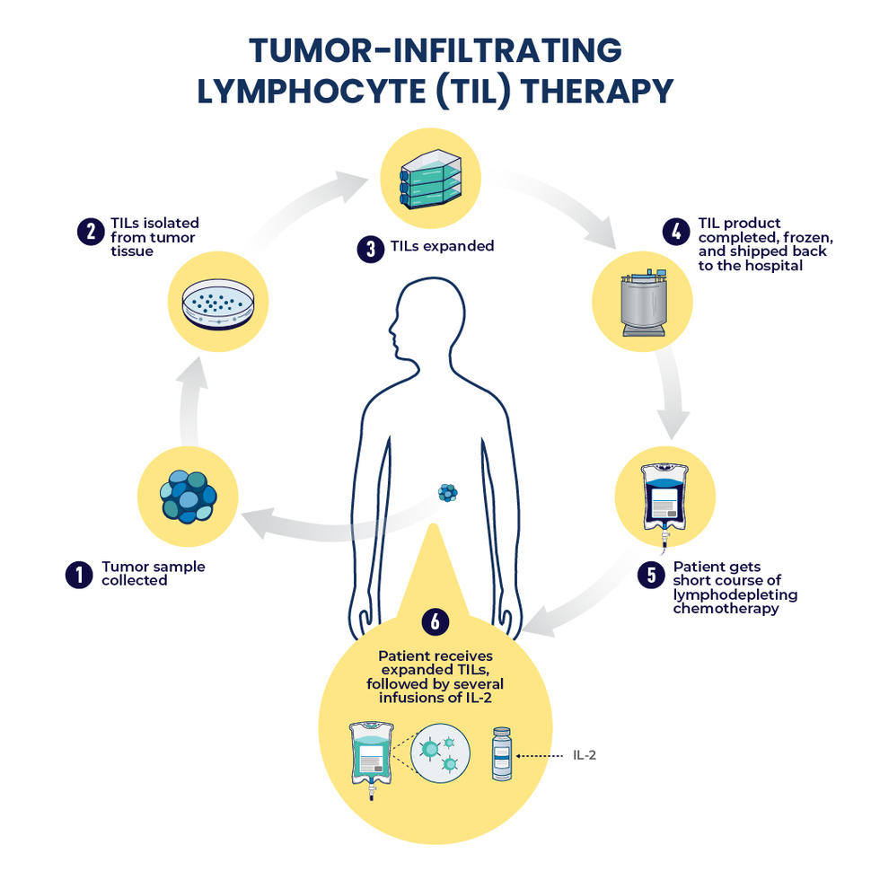 An infographic showing the basis steps involved in TIL therapy