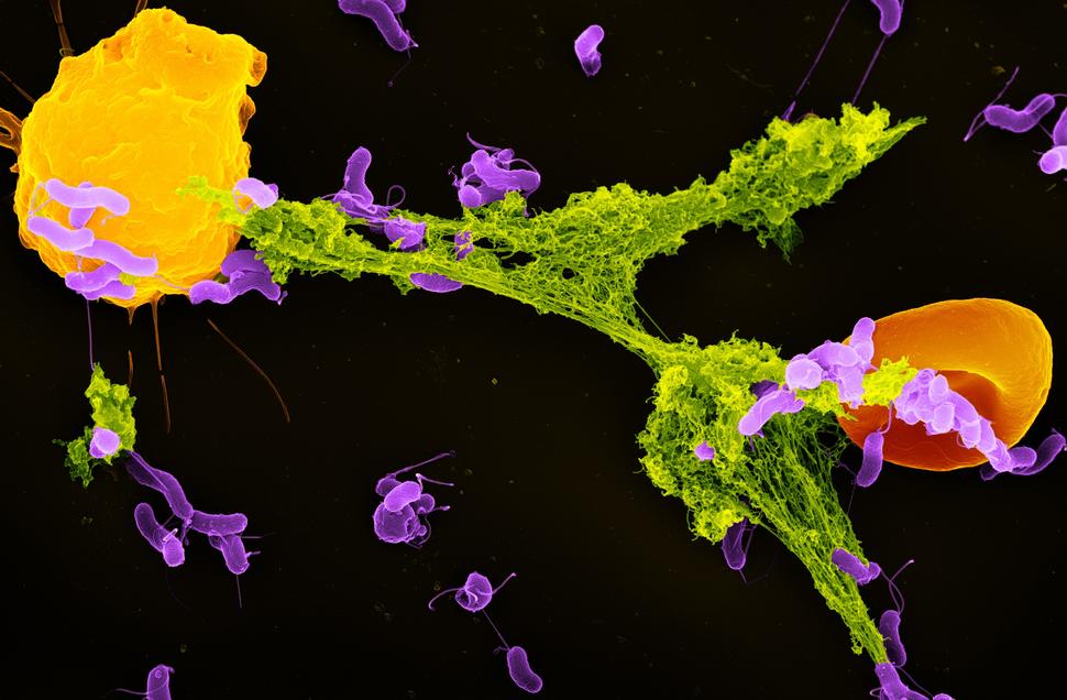 An electron microscope image of a neutrophil ejecting a NET that has captured bacteria