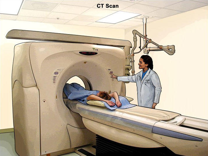 Tomography Scans Fact Sheet - NCI