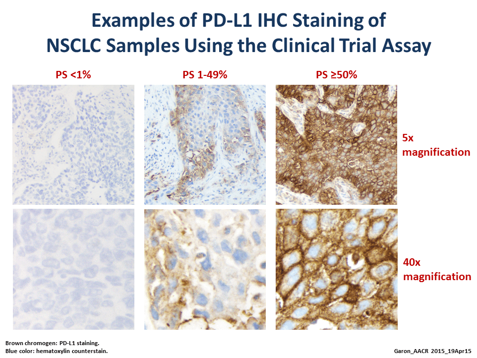 keytruda prostate cancer clinical trials