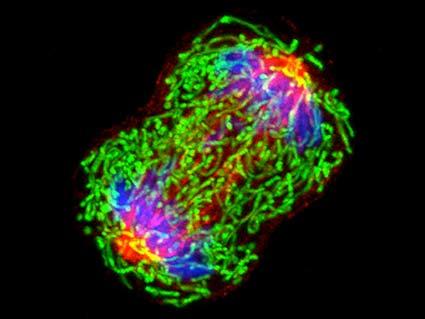 A dividing breast cancer cell.