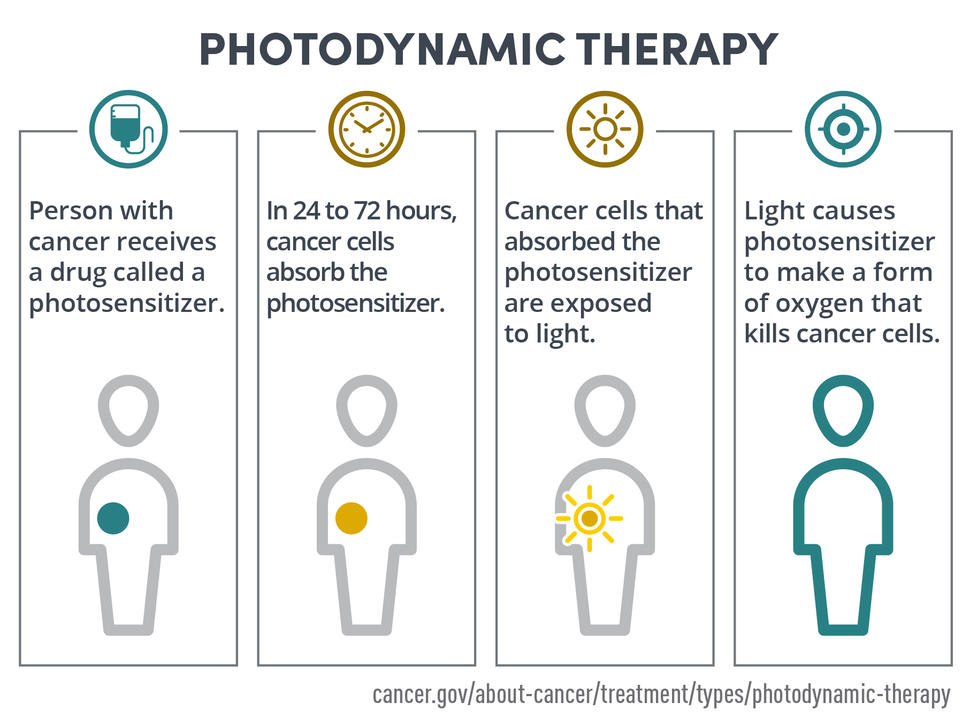 Photodynamic Therapy Process Infographic