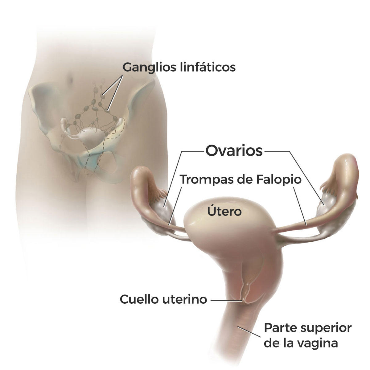 Cirugia De Ganglios Linfaticos Para Cancer Avanzado De Ovario Instituto Nacional Del Cancer
