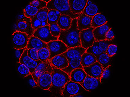 Pancreatic cancer cells growing in a sphere-shaped cluster.