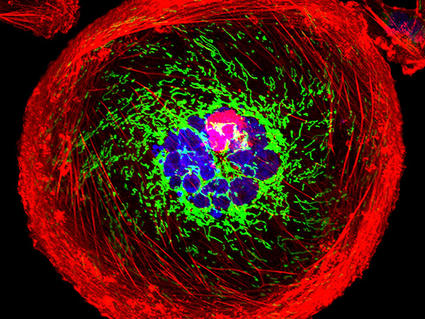 A polyploid giant cancer cell from triple-negative breast cancer in which actin is red, mitochondria are green, and nuclear DNA is blue.