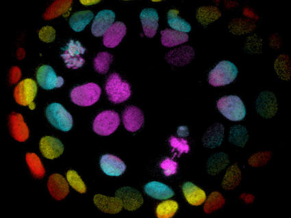 Colorectal cancer cells stained different colors, against a black background