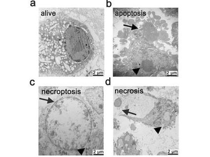 Microscope images showing a live cell and cells undergoing apoptosis, necroptosis, and necrosis.