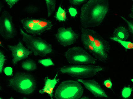 Microscope images of macrophage immune cells that have engulfed breast cancer cells treated with a CD24-blocking antibody.