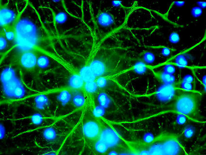 An astrocyte in culture emitting long, winding extensions.