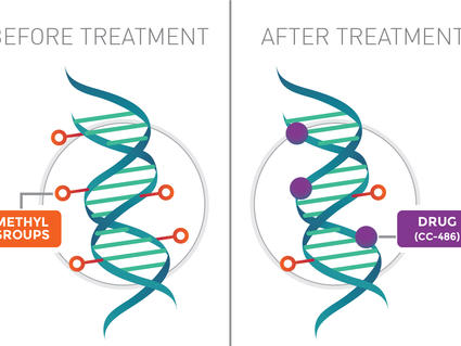 A graphic showing the drug CC-486 interacting with DNA and preventing DNA methylation