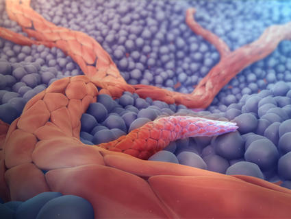 Angiogenesis medical animation still