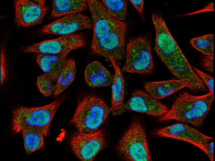 Image of cells with POLQ stained green.