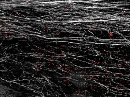 Image of white fiber structures and red cells on black background