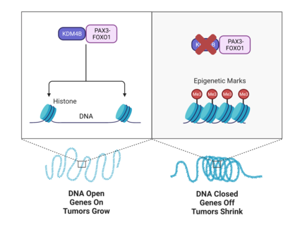 An illustration with two panels. On the left, PAX3-FOXO1 interacts with KDM4B in front of stretched-out DNA. On the right, KDM4B is crossed out and the DNA is wound up.
