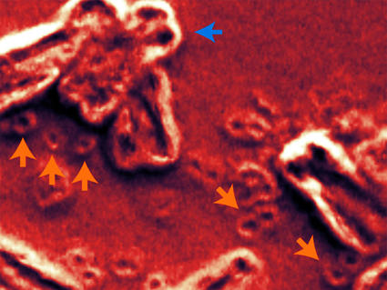 A scanning electron micrograph showing chromosomes and ecDNA