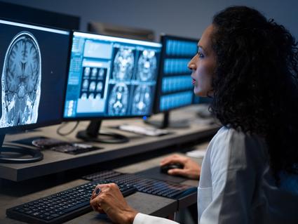 A radiation technologist analyzes brain MRI images on a computer screen