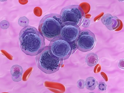 An illustration of AML cells floating among other cells