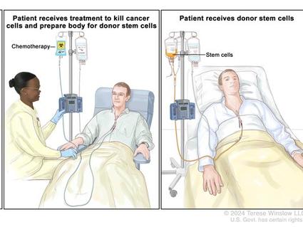 3 panels showing the stem cell transplant process 