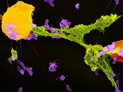 An electron microscope image of a neutrophil ejecting a NET that has captured bacteria