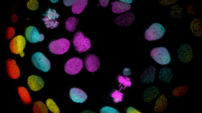 Colorectal cancer cells stained different colors, against a black background