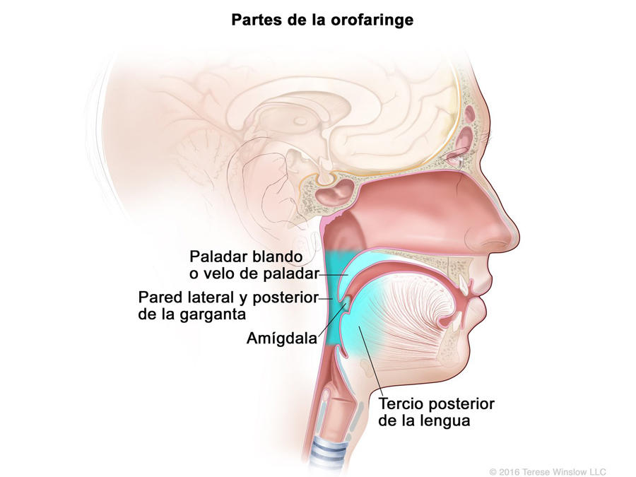 vph en el tratamiento de la garganta
