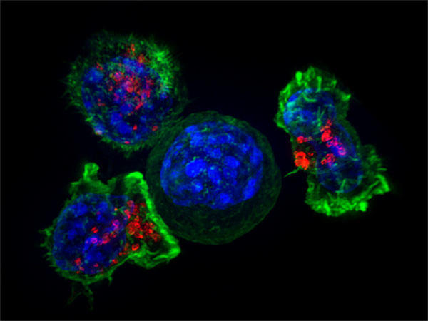 opdivo y cáncer de próstata