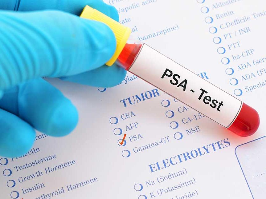 prostate check blood test