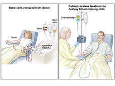 Synthetic Biology Used To Target Cancer Cells While Sparing Healthy Tissue | News Center | Stanford Medicine