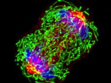 Una célula de cáncer de seno (mama) que se multiplica.