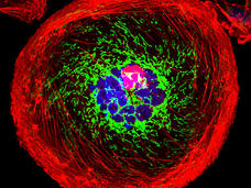 A polyploid giant cancer cell from triple-negative breast cancer in which actin is red, mitochondria are green, and nuclear DNA is blue.