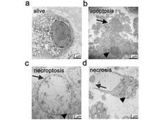 Microscope images showing a live cell and cells undergoing apoptosis, necroptosis, and necrosis.