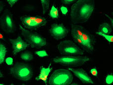 Microscope images of macrophage immune cells that have engulfed breast cancer cells treated with a CD24-blocking antibody.