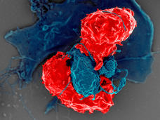 Scanning electron microscope image of T cells interacting with antigen-presenting cells.