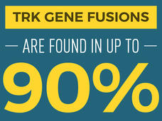 TRK Gene Fusions are found in up to 90% of rare cancers