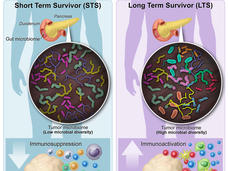 Illustration of tumor microbiome in short- and long-term survivors of pancreatic cancer.